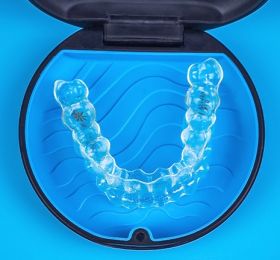 Diagnóstico, planejamento e biomecânica com o Sistema Invisalign