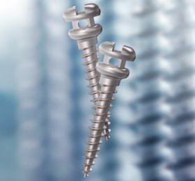 Mini Implantes - Intra e Extra Alveolares