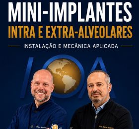 Mini Implantes - Intra e Extra Alveolares