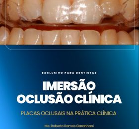Oclusão Clínica - Uso, Sobreuso e Placas Oclusais
