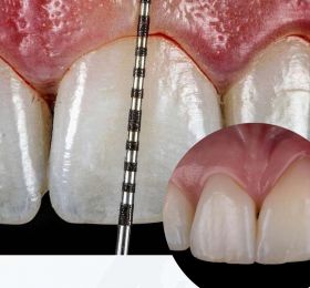 Aperfeiçoamento em Periodontia com Ênfase em Cirurgia Periodontal